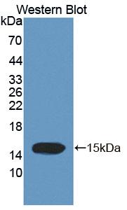 TCHH / Trichohyalin Antibody - Western blot of TCHH / Trichohyalin antibody.