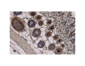 TCHH / Trichohyalin Antibody - Immunohistochemistry (Formalin/PFA-fixed paraffin-embedded sections) - Trichohyalin antibody [AE15] staining Trichohyalin in Mouse skin tissue sections 