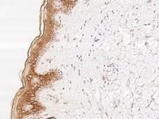 TCHHL1 Antibody - Immunochemical staining of human TCHHL1 in human skin with rabbit polyclonal antibody at 1:500 dilution, formalin-fixed paraffin embedded sections.