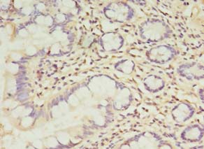 TCHP Antibody - Immunohistochemistry of paraffin-embedded human small intestine tissue using antibody at 1:100 dilution.