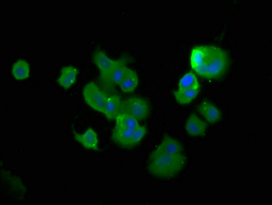 TCHP Antibody - Immunofluorescence staining of MCF-7 cells with TCHP Antibody at 1:400, counter-stained with DAPI. The cells were fixed in 4% formaldehyde, permeabilized using 0.2% Triton X-100 and blocked in 10% normal Goat Serum. The cells were then incubated with the antibody overnight at 4°C. The secondary antibody was Alexa Fluor 488-congugated AffiniPure Goat Anti-Rabbit IgG(H+L).