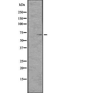 TCHP Antibody - Western blot analysis of TCHP expression in CEM cells lysate. The lane on the left is treated with the antigen-specific peptide.