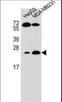 TCL / RHOJ Antibody - RHOJ Antibody western blot of HepG2,MDA-MB231 cell line lysates (35 ug/lane). The RHOJ antibody detected the RHOJ protein (arrow).