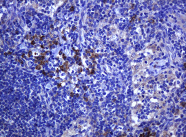 TCL / RHOJ Antibody - IHC of paraffin-embedded Human lymph node tissue using anti-RHOJ mouse monoclonal antibody. (Heat-induced epitope retrieval by 10mM citric buffer, pH6.0, 120°C for 3min).