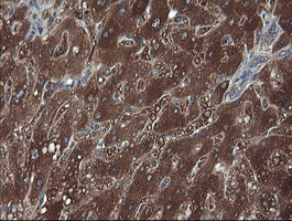 TCL / RHOJ Antibody - IHC of paraffin-embedded Human liver tissue using anti-RHOJ mouse monoclonal antibody. (Heat-induced epitope retrieval by 10mM citric buffer, pH6.0, 120°C for 3min).