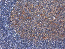 TCL / RHOJ Antibody - IHC of paraffin-embedded Human tonsil using anti-RHOJ mouse monoclonal antibody. (Heat-induced epitope retrieval by 10mM citric buffer, pH6.0, 120°C for 3min).