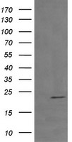 TCL / RHOJ Antibody - HEK293T cells were transfected with the pCMV6-ENTRY control (Left lane) or pCMV6-ENTRY RHOJ (Right lane) cDNA for 48 hrs and lysed. Equivalent amounts of cell lysates (5 ug per lane) were separated by SDS-PAGE and immunoblotted with anti-RHOJ.