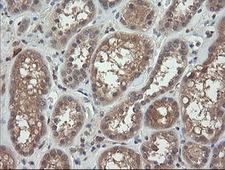 TCL / RHOJ Antibody - IHC of paraffin-embedded Human Kidney tissue using anti-RHOJ mouse monoclonal antibody.