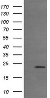 TCL / RHOJ Antibody - HEK293T cells were transfected with the pCMV6-ENTRY control (Left lane) or pCMV6-ENTRY RHOJ (Right lane) cDNA for 48 hrs and lysed. Equivalent amounts of cell lysates (5 ug per lane) were separated by SDS-PAGE and immunoblotted with anti-RHOJ.
