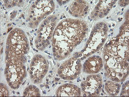 TCL / RHOJ Antibody - IHC of paraffin-embedded Human Kidney tissue using anti-RHOJ mouse monoclonal antibody.