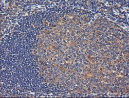 TCL / RHOJ Antibody - IHC of paraffin-embedded Human tonsil using anti-RHOJ mouse monoclonal antibody.