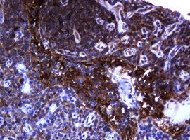 TCL / RHOJ Antibody - IHC of paraffin-embedded Human lymph node tissue using anti-RHOJ mouse monoclonal antibody.