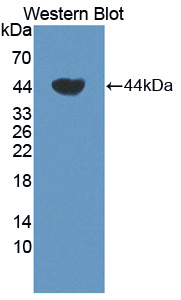 TCN1 Antibody - Western blot of TCN1 antibody.