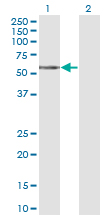 TCN1 Antibody - Western blot of TCN1 expression in transfected 293T cell line by TCN1 monoclonal antibody (M12), clone 3F10.