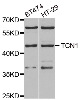 TCN1 Antibody - Western blot analysis of extracts of various cell lines.
