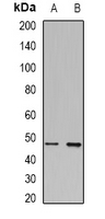 TCN1 Antibody - Western blot analysis of Transcobalamin-1 expression in BT474 (A); HT29 (B) whole cell lysates.