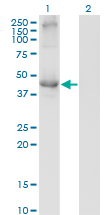 TCN2 Antibody - Western Blot analysis of TCN2 expression in transfected 293T cell line by TCN2 monoclonal antibody (M01), clone 2F4.Lane 1: TCN2 transfected lysate (Predicted MW: 47.5 KDa).Lane 2: Non-transfected lysate.