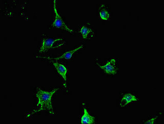 TCN2 Antibody - Immunofluorescent analysis of U251 cells using TCN2 Antibody at dilution of 1:100 and Alexa Fluor 488-congugated AffiniPure Goat Anti-Rabbit IgG(H+L)