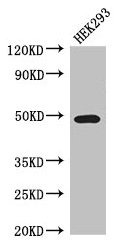 TCN2 Antibody - Western Blot Positive WB detected in: HEK293 whole cell lysate, MCF-7 whole cell lysate, A549 whole cell lysate All lanes: TCN2 antibody at 3.5µg/ml Secondary Goat polyclonal to rabbit IgG at 1/50000 dilution Predicted band size: 48, 45 kDa Observed band size: 48, 80 kDa