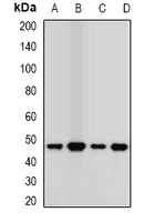 TCN2 Antibody - Western blot analysis of Transcobalamin-2 expression in MCF7 (A); A549 (B); mouse kidney (C); mouse lung (D) whole cell lysates.
