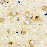 TCN2 Antibody - Immunohistochemical analysis of Transcobalamin-2 staining in mouse brain formalin fixed paraffin embedded tissue section. The section was pre-treated using heat mediated antigen retrieval with sodium citrate buffer (pH 6.0). The section was then incubated with the antibody at room temperature and detected using an HRP conjugated compact polymer system. DAB was used as the chromogen. The section was then counterstained with hematoxylin and mounted with DPX.
