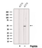 TCN2 Antibody - Western blot analysis of extracts of A375 cells using TCN2 antibody. The lane on the left was treated with blocking peptide.