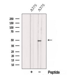 TCN2 Antibody - Western blot analysis of extracts of A375 cells using TCN2 antibody. The lane on the left was treated with blocking peptide.