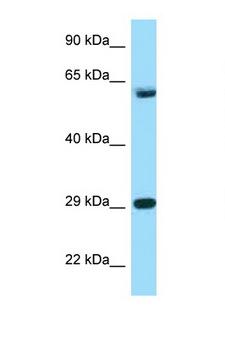 TCP1 Antibody - TCP1 antibody Western blot of HeLa Cell lysate. Antibody concentration 1 ug/ml.  This image was taken for the unconjugated form of this product. Other forms have not been tested.