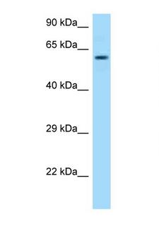 TCP1 Antibody - TCP1 antibody Western blot of Placenta lysate. Antibody concentration 1 ug/ml.  This image was taken for the unconjugated form of this product. Other forms have not been tested.