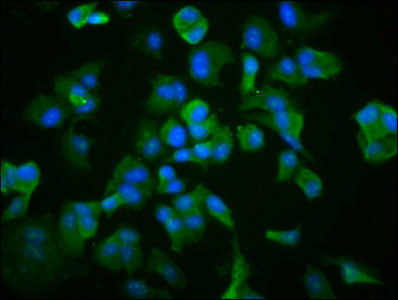 TCP1 Antibody - Immunofluorescence staining of MCF-7 cells with TCP1 Antibody at 1:266, counter-stained with DAPI. The cells were fixed in 4% formaldehyde, permeabilized using 0.2% Triton X-100 and blocked in 10% normal Goat Serum. The cells were then incubated with the antibody overnight at 4°C. The secondary antibody was Alexa Fluor 488-congugated AffiniPure Goat Anti-Rabbit IgG(H+L).