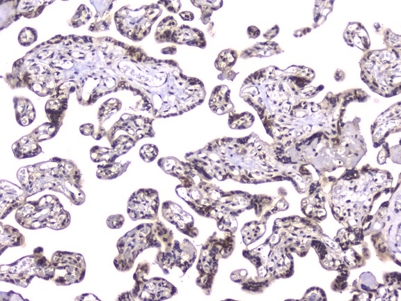 TCP1 Antibody - IHC analysis of TCP1 alpha using anti-TCP1 alpha antibody. TCP1 alpha was detected in paraffin-embedded section of human placenta tissue. Heat mediated antigen retrieval was performed in citrate buffer (pH6, epitope retrieval solution) for 20 mins. The tissue section was blocked with 10% goat serum. The tissue section was then incubated with 2µg/ml mouse anti-TCP1 alpha Antibody overnight at 4°C. Biotinylated goat anti-mouse IgG was used as secondary antibody and incubated for 30 minutes at 37°C. The tissue section was developed using Strepavidin-Biotin-Complex (SABC) with DAB as the chromogen.