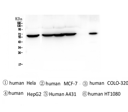 TCP1 Antibody - Western blot analysis of TCP1 alpha using anti-TCP1 alpha antibody. Electrophoresis was performed on a 5-20% SDS-PAGE gel at 70V (Stacking gel) / 90V (Resolving gel) for 2-3 hours. The sample well of each lane was loaded with 50ug of sample under reducing conditions. Lane 1: human Hela whole cell lysates, Lane 2: human MCF-7 whole cell lysates, Lane 3: human COLO-320 whole cell lysates, Lane 4: human HepG2 whole cell lysates, Lane 5: human A431 whole cell lysates, Lane 6: human HT1080 whole cell lysates. After Electrophoresis, proteins were transferred to a Nitrocellulose membrane at 150mA for 50-90 minutes. Blocked the membrane with 5% Non-fat Milk/ TBS for 1.5 hour at RT. The membrane was incubated with mouse anti-TCP1 alpha antigen affinity purified monoclonal antibody at 0.5 µg/mL overnight at 4°C, then washed with TBS-0.1% Tween 3 times with 5 minutes each and probed with a Biotin Conjugated goat anti-mouse IgG secondary antibody at a dilution of 1:10000 for 1.5 hour at RT. The signal is developed using an Enhanced Chemiluminescent detection (ECL) kit with Tanon 5200 system.