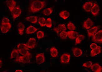 TCP1 Antibody - Staining JK cells by IF/ICC. The samples were fixed with PFA and permeabilized in 0.1% Triton X-100, then blocked in 10% serum for 45 min at 25°C. The primary antibody was diluted at 1:200 and incubated with the sample for 1 hour at 37°C. An Alexa Fluor 594 conjugated goat anti-rabbit IgG (H+L) Ab, diluted at 1/600, was used as the secondary antibody.