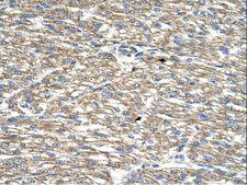 TCP10 Antibody - TCP10 antibody TCP10L(t-complex 10 (mouse)-like) Antibody was used in IHC to stain formalin-fixed, paraffin-embedded human heart.  This image was taken for the unconjugated form of this product. Other forms have not been tested.