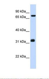 TCP10 Antibody - Hela cell lysate. Antibody concentration: 1.0 ug/ml. Gel concentration: 12%.  This image was taken for the unconjugated form of this product. Other forms have not been tested.