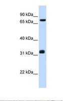 TCP10 Antibody - Hela cell lysate. Antibody concentration: 1.0 ug/ml. Gel concentration: 12%.  This image was taken for the unconjugated form of this product. Other forms have not been tested.