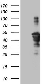 TCP10 Antibody - HEK293T cells were transfected with the pCMV6-ENTRY control. (Left lane) or pCMV6-ENTRY TCP10. (Right lane) cDNA for 48 hrs and lysed. Equivalent amounts of cell lysates. (5 ug per lane) were separated by SDS-PAGE and immunoblotted with anti-TCP10. (1:2000)