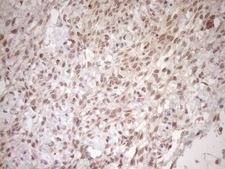 TCP10 Antibody - Immunohistochemical staining of paraffin-embedded Human Ovary tissue within the normal limits using anti-TCP10 mouse monoclonal antibody. (Heat-induced epitope retrieval by 1mM EDTA in 10mM Tris buffer. (pH8.5) at 120°C for 3 min. (1:150)