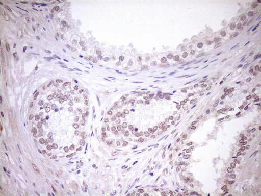 TCP10 Antibody - Immunohistochemical staining of paraffin-embedded Human prostate tissue within the normal limits using anti-TCP10 mouse monoclonal antibody. (Heat-induced epitope retrieval by 1mM EDTA in 10mM Tris buffer. (pH8.5) at 120°C for 3 min. (1:150)