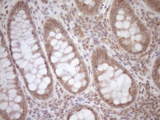 TCP10 Antibody - Immunohistochemical staining of paraffin-embedded Human colon tissue within the normal limits using anti-TCP10 mouse monoclonal antibody. (Heat-induced epitope retrieval by 1mM EDTA in 10mM Tris buffer. (pH8.5) at 120°C for 3 min. (1:150)