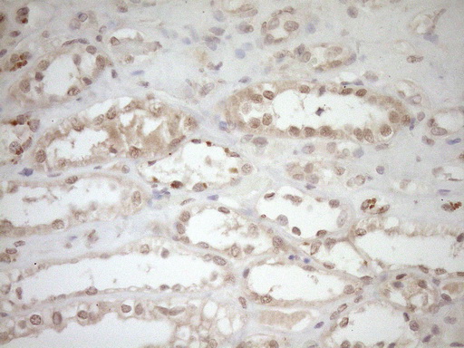 TCP10 Antibody - Immunohistochemical staining of paraffin-embedded Human Kidney tissue within the normal limits using anti-TCP10 mouse monoclonal antibody. (Heat-induced epitope retrieval by 1mM EDTA in 10mM Tris buffer. (pH8.5) at 120°C for 3 min. (1:150)