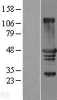 TCP10 Protein - Western validation with an anti-DDK antibody * L: Control HEK293 lysate R: Over-expression lysate
