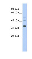 TCP11 Antibody - TCP11 antibody Western blot of DU145 cell lysate. This image was taken for the unconjugated form of this product. Other forms have not been tested.