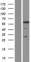 TCP11 Protein - Western validation with an anti-DDK antibody * L: Control HEK293 lysate R: Over-expression lysate