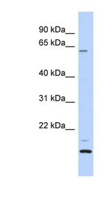 TCP11L2 Antibody - TCP11L2 antibody Western blot of Fetal Heart lysate. This image was taken for the unconjugated form of this product. Other forms have not been tested.