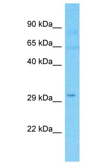 TCP11L2 Antibody - TCP11L2 antibody Western Blot of Thymus Tumor. Antibody dilution: 1 ug/ml.  This image was taken for the unconjugated form of this product. Other forms have not been tested.