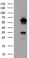 TCP11L2 Antibody - HEK293T cells were transfected with the pCMV6-ENTRY control (Left lane) or pCMV6-ENTRY TCP11L2 (Right lane) cDNA for 48 hrs and lysed. Equivalent amounts of cell lysates (5 ug per lane) were separated by SDS-PAGE and immunoblotted with anti-TCP11L2.