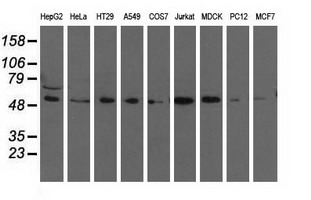 TCP11L2 Antibody - Western blot analysis of extracts (35ug) from 9 different cell lines by using anti-TCP11L2 monoclonal antibody.