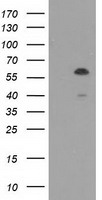 TCP11L2 Antibody - HEK293T cells were transfected with the pCMV6-ENTRY control (Left lane) or pCMV6-ENTRY TCP11L2 (Right lane) cDNA for 48 hrs and lysed. Equivalent amounts of cell lysates (5 ug per lane) were separated by SDS-PAGE and immunoblotted with anti-TCP11L2.