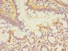 TCP11L2 Antibody - Immunohistochemistry of paraffin-embedded human small intestine tissue using antibody at dilution of 1:100.